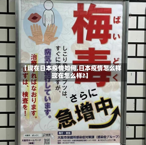 【现在日本疫情如何,日本疫情怎么样现在怎么样?】