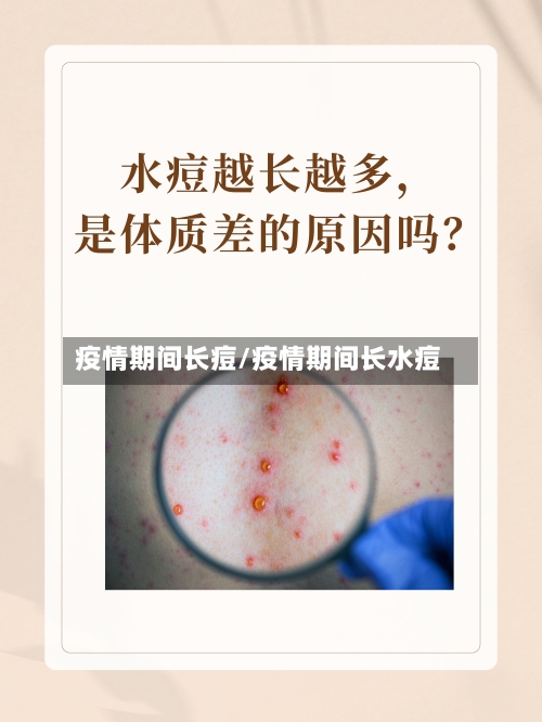 疫情期间长痘/疫情期间长水痘