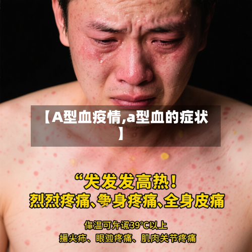 【A型血疫情,a型血的症状】-第3张图片