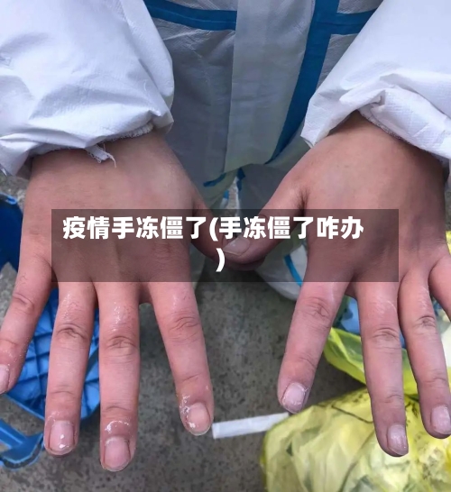 疫情手冻僵了(手冻僵了咋办)-第2张图片