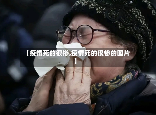 【疫情死的很惨,疫情死的很惨的图片】-第3张图片