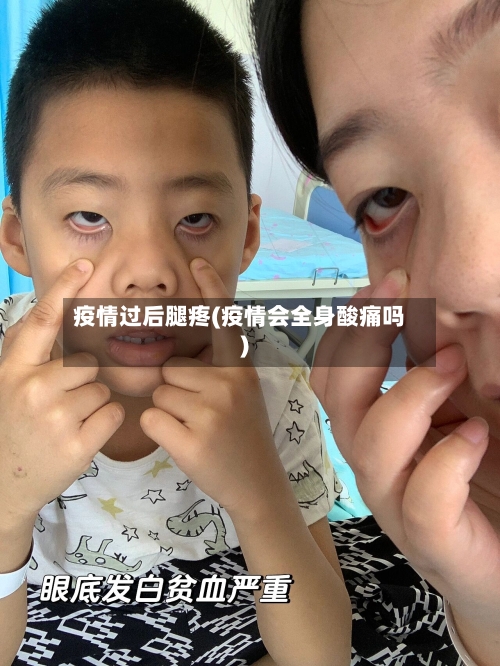 疫情过后腿疼(疫情会全身酸痛吗)-第2张图片