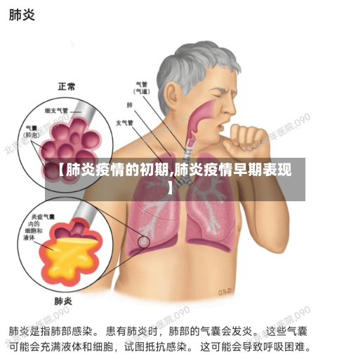 【肺炎疫情的初期,肺炎疫情早期表现】