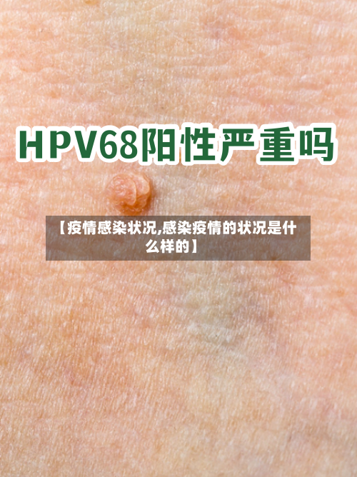 【疫情感染状况,感染疫情的状况是什么样的】-第2张图片