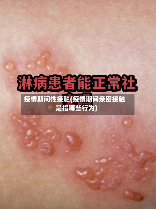 疫情期间性接触(疫情期间亲密接触是指哪些行为)-第2张图片