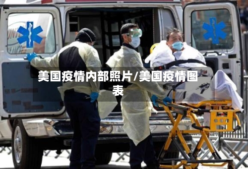 美国疫情内部照片/美国疫情图表