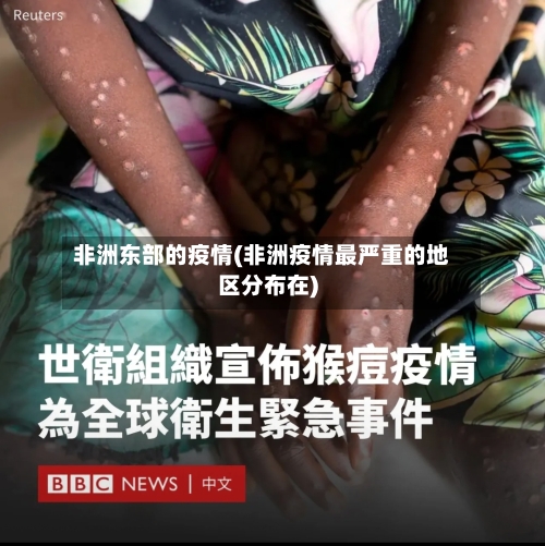 非洲东部的疫情(非洲疫情最严重的地区分布在)-第2张图片